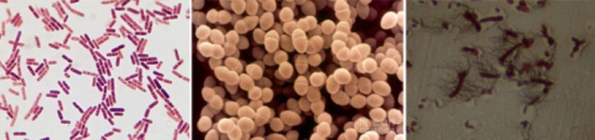 E. coli, entérocoque fécal et proteus sont les principaux agents responsables de la prostatite bactérienne chronique