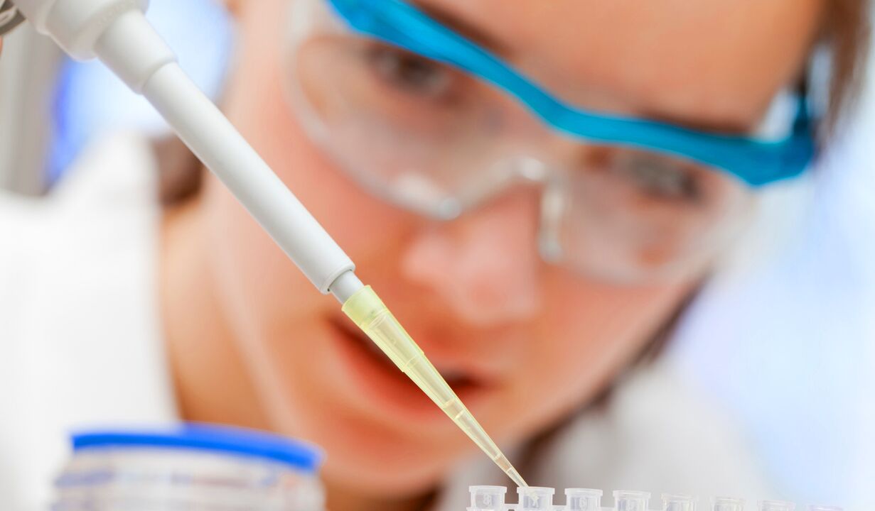 Analyse en laboratoire de l'urine - une méthode de diagnostic de la prostatite
